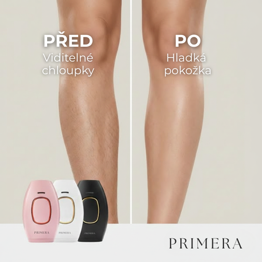 Primera™ IPL Epilator - Hair Removal Device