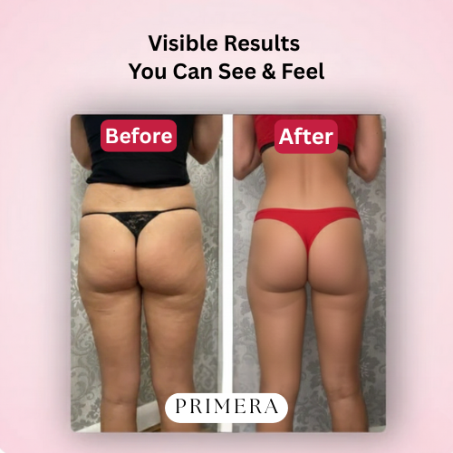 Primera™ PRO - Anti-Cellulite Body Sculpting Set