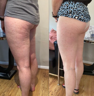 Sophie D., 37 | London