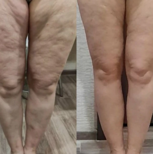 Clara W., 33 | Birmingham